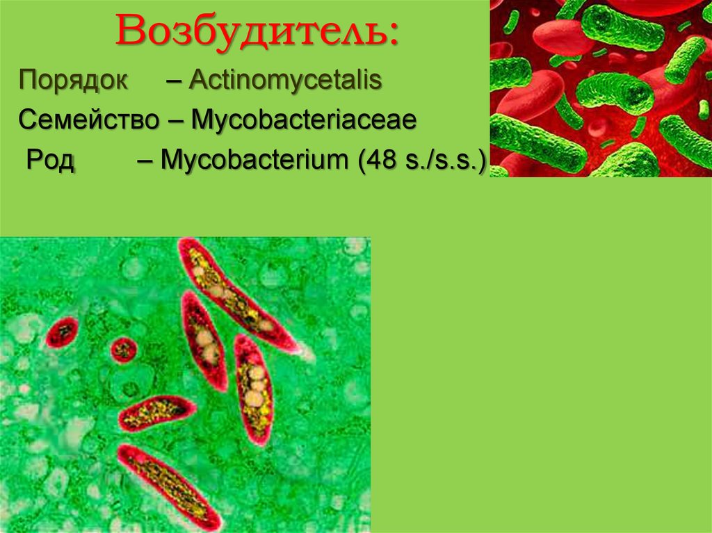 Туберкулез презентация на английском