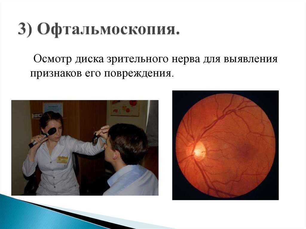 Офтальмоскопия что это. Непрямая офтальмоскопия глазного дна. Прибор для осмотра глазного дна. Осмотр глазного дна зрительный нерв. Офтальмоскопия диска зрительного нерва.