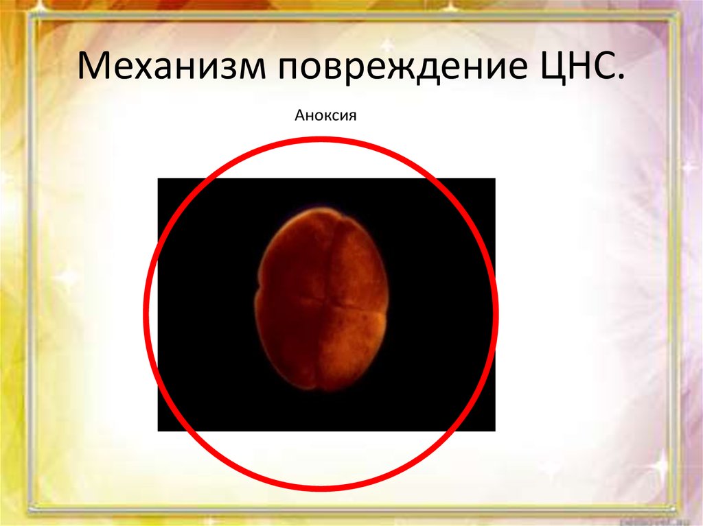 Механизм повреждение ЦНС.