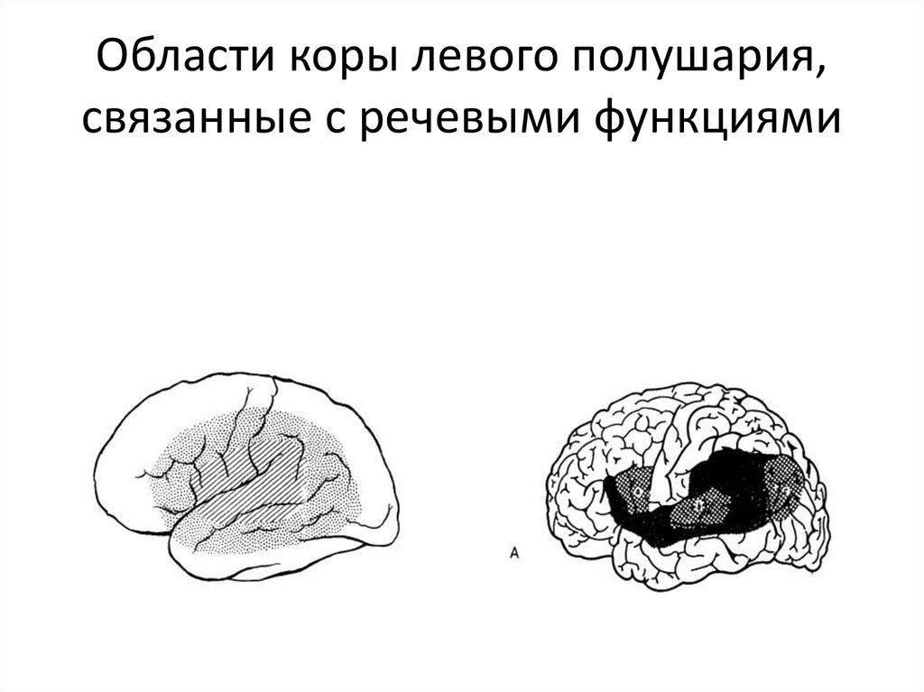 Поражение левого полушария мозга. Области коры левого полушария связанные с речевыми функциями. Речевые функции левого полушария. Речевые функции левого полушария головного мозга. Поражение коры левого полушария.