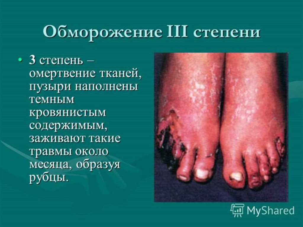 3 и 4 степени