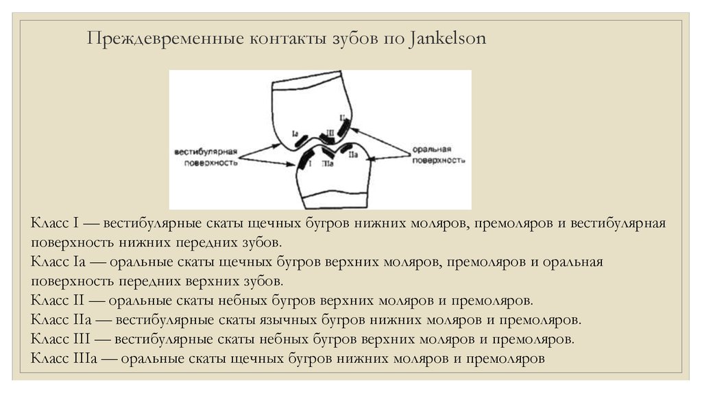 Схема окклюзионных контактов - 87 фото