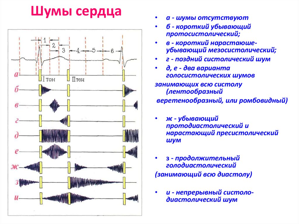 Виды шумов на изображении