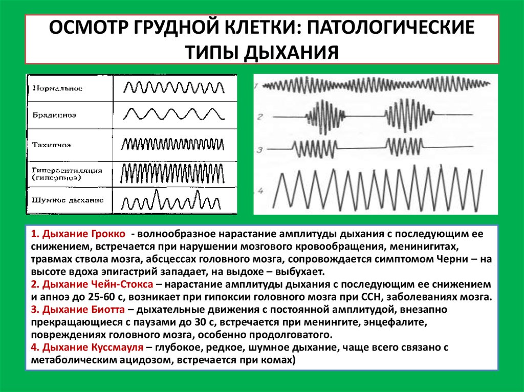 Типы дыхания картинка