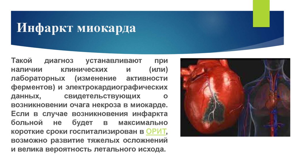 протяжении причины возникновения инфаркта миокарда сложно, если есть