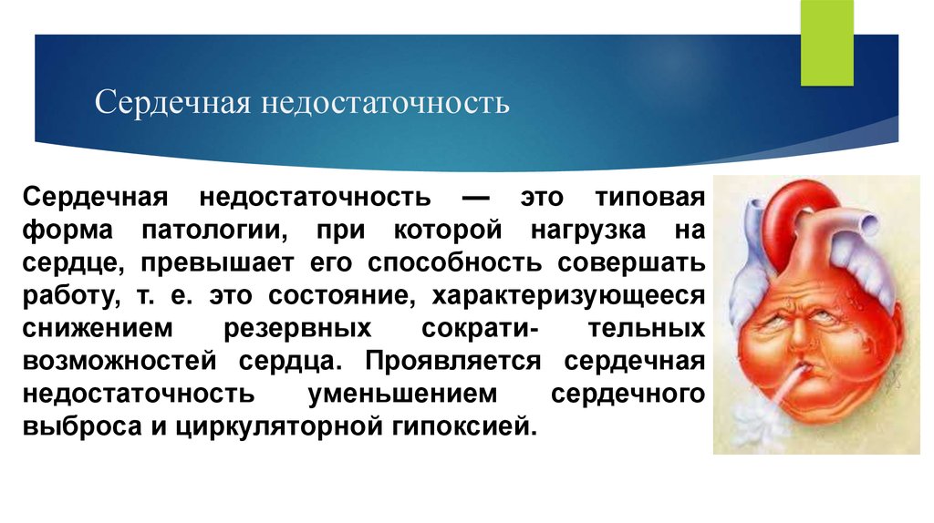 Сердце без застойной сердечной недостаточности. Сердечная недостаточность. Сердечная недостаточность патология. Сердечная недостатостьэто. Застойная сердечная недостаточность.