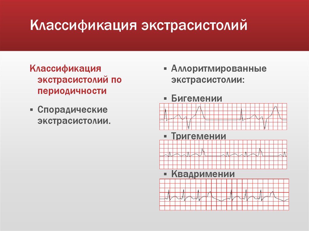 Экстрасистолия на фоне стресса форум