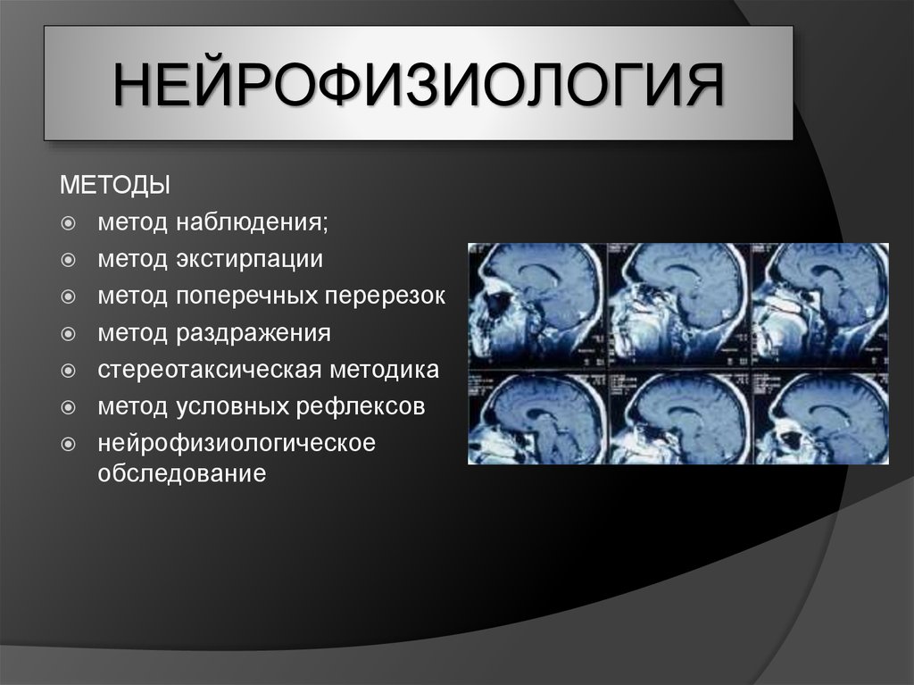 Нейрофизиология картинки для презентации