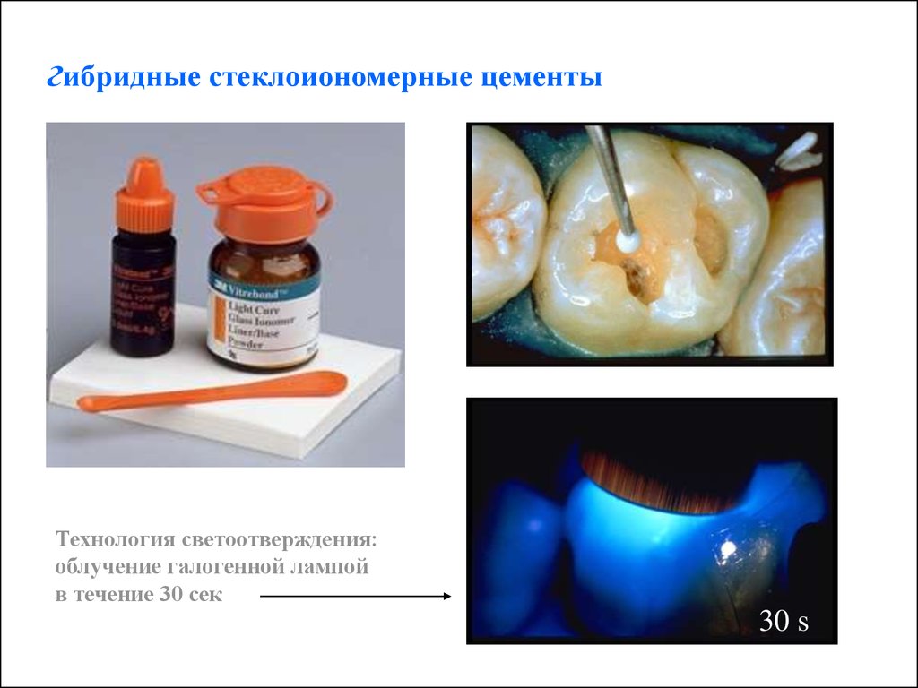 Стеклоиономерные цементы в стоматологии презентация