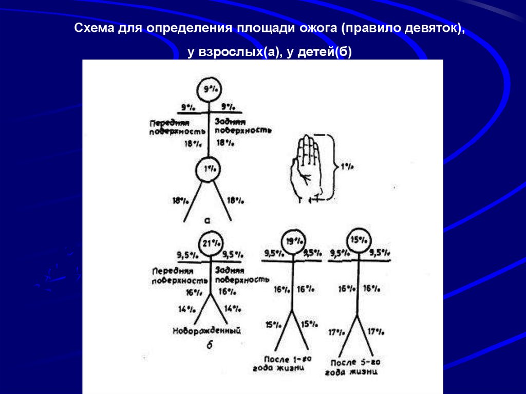 Оценка площади ожога проводится по схеме