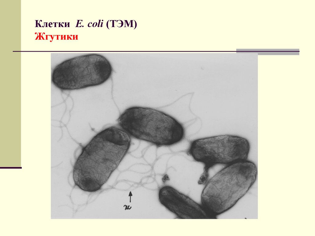 Е клетка. Жгутики бактериальной клетки. Клетки e coli. Негативное контрастирование бактерий. E. coli строение клетки.