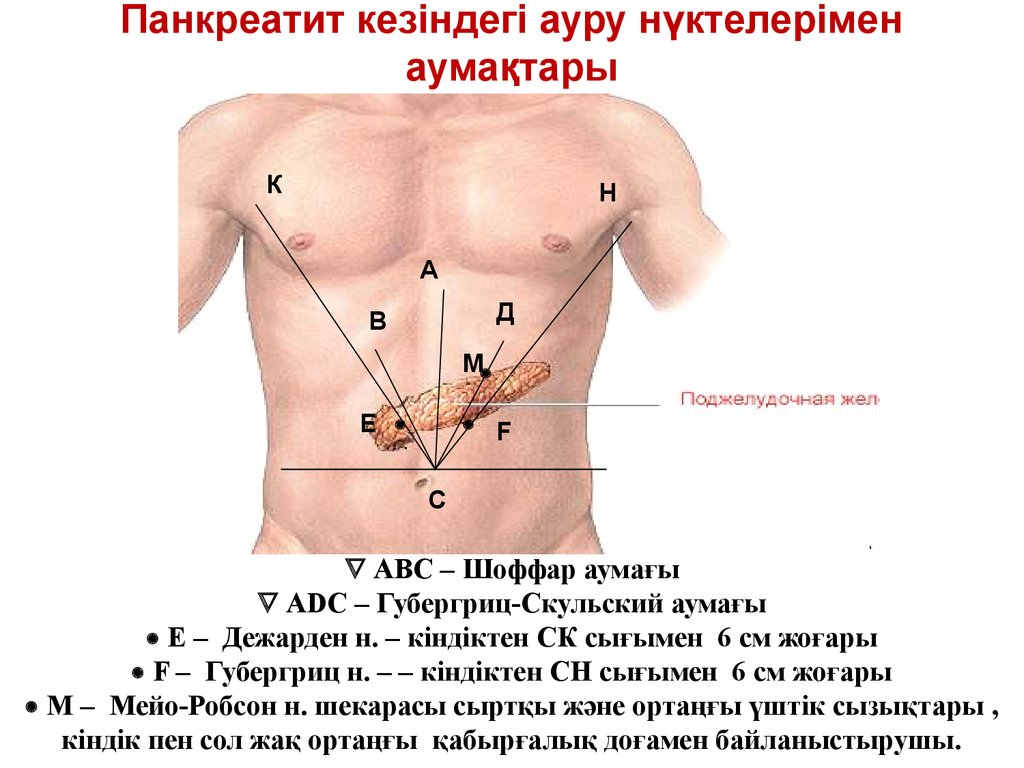 Панкреатит статистика