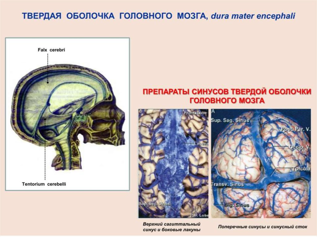 Синусы оболочки головного мозга. Синусы твердой оболочки головного мозга схема. Синусы твердой оболочки головного мозга парные. Венозные синусы головного мозга. Строение синуса головного мозга.