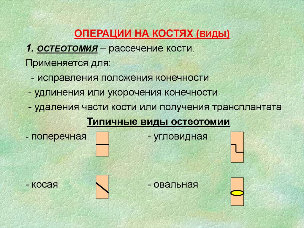 Операции на костях. Виды операций на костях. Типичные операции на костях. Виды операций: операции на костях.