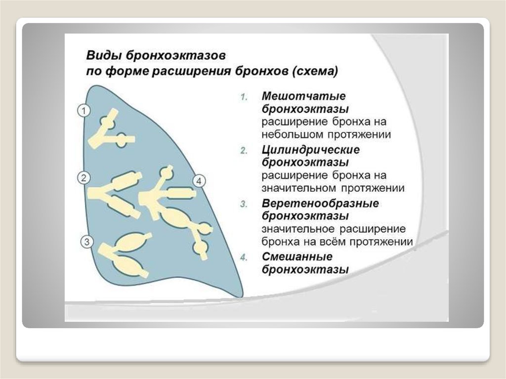 Приобретенные бронхоэктазы