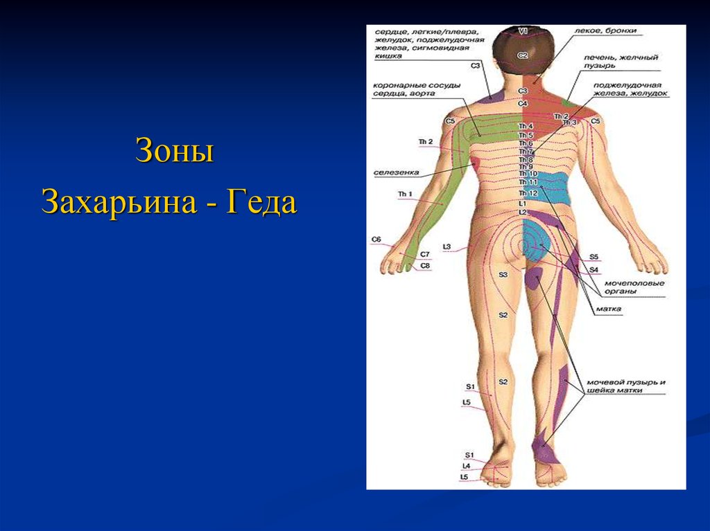 Зона боли. Зоны кожной гиперестезии Захарьина Геда. Зоны Захарьина-Геда схема. Рефлекторные зоны Захарьина-Геда схема. Рефлекторные зоны Захарьина-Геда.