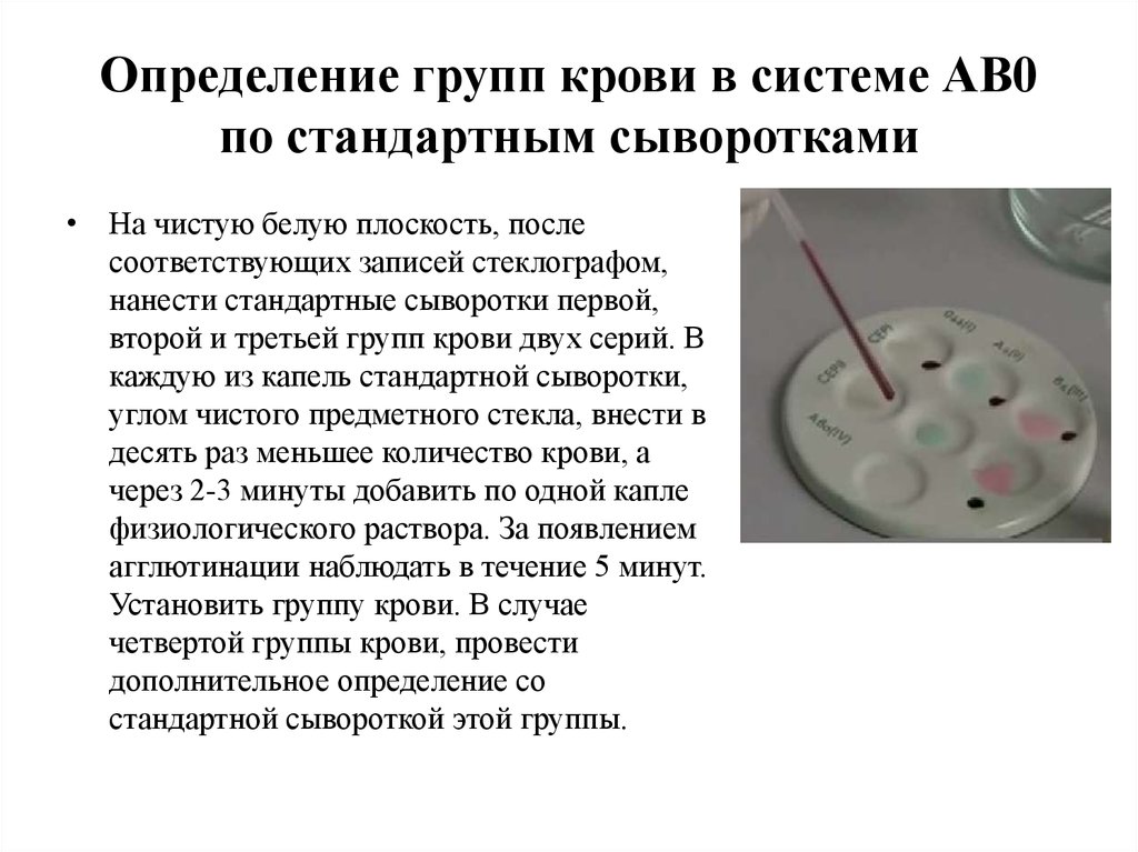 Сыворотка 1 группы крови. Определение групп крови по стандартным сывороткам. Определение группы крови методом стандартных сывороток. Методика определения групп крови и их совместимость.. Определение группы крови крови по стандартным сывороткам.