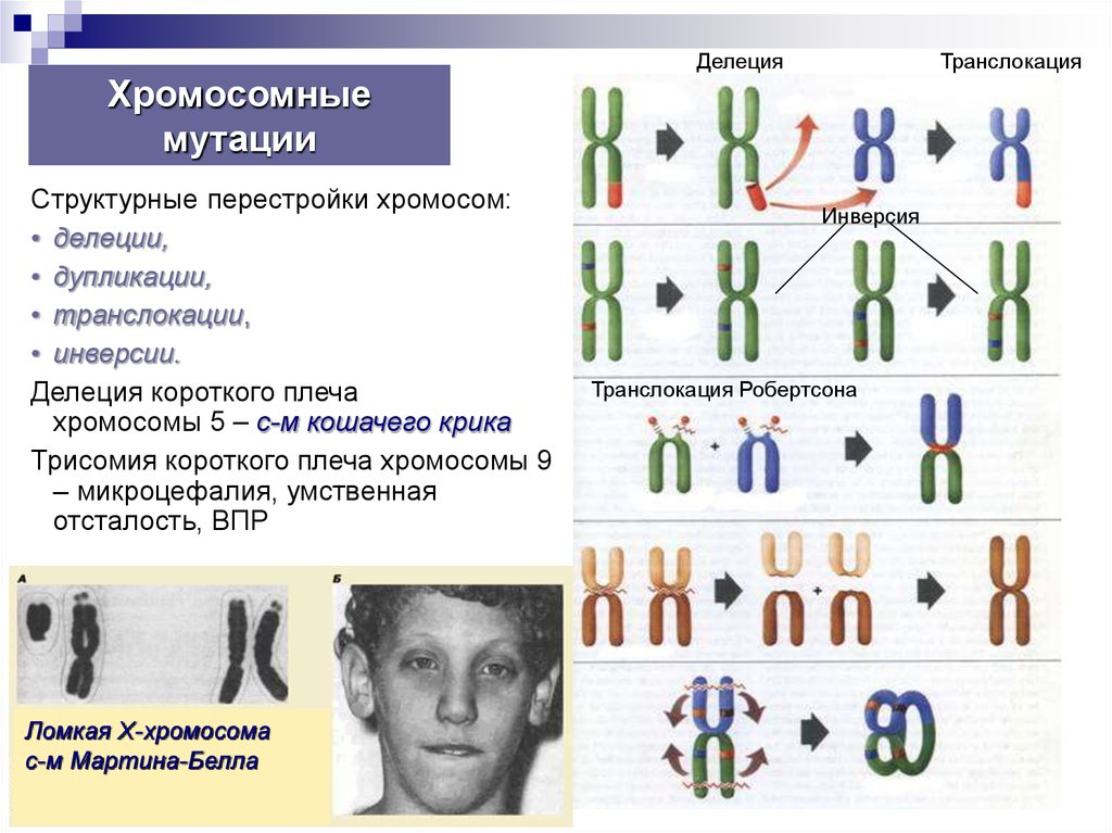 Пересадка хромосом. Структурная перестройка хромосом кариотип. Хромосомные болезни связанные с изменением структуры хромосом. Трисомия короткого плеча 9 хромосомы. Хромосомные мутации хромосомные мутации.