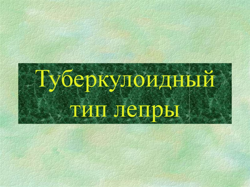 Туберкулоидный тип лепры