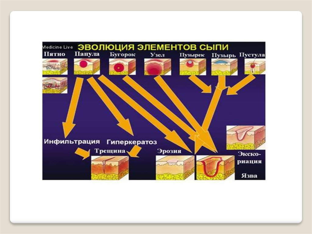 Элементы сыпи. Эволюция элементов сыпи. Эволюция элементы кожной сыпи классификация. Динамика развития элементов сыпи. Элементы эволюции.