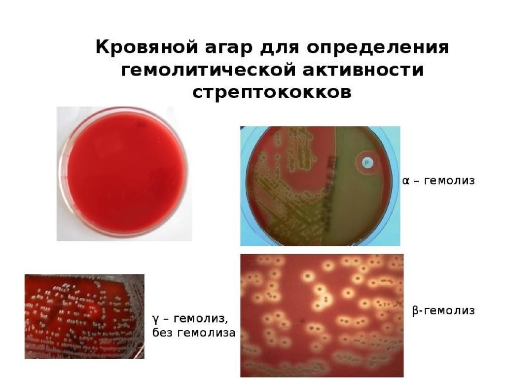 Альфа гемолиз. Стрептококки гемолиз на кровяном агаре. Среда кровяной агар микробиология. Стрептококки на кровяном агаре микробиология. Сахарно кровяной агар Цейсслера.