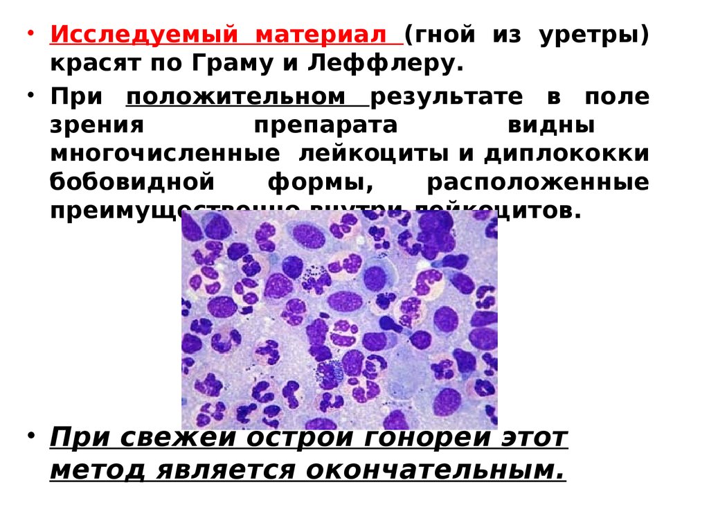 Исследуемый материал. Лейкоциты окрашенные по Граму. Диплококки окраска по Граму результат.