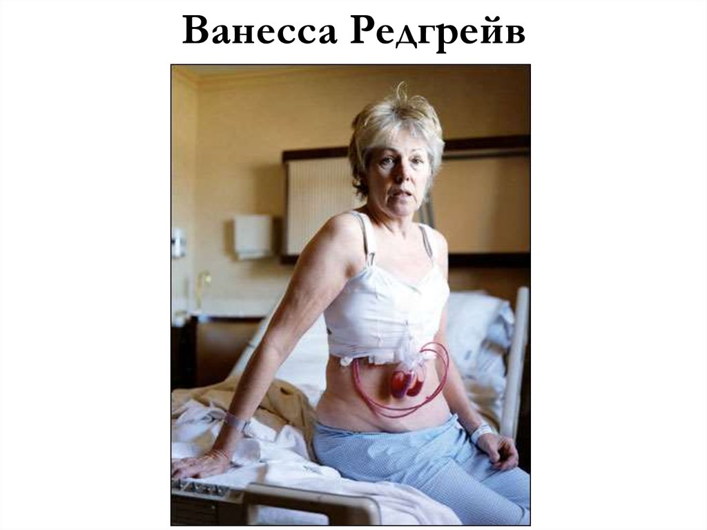 Ванесса Редгрейв
