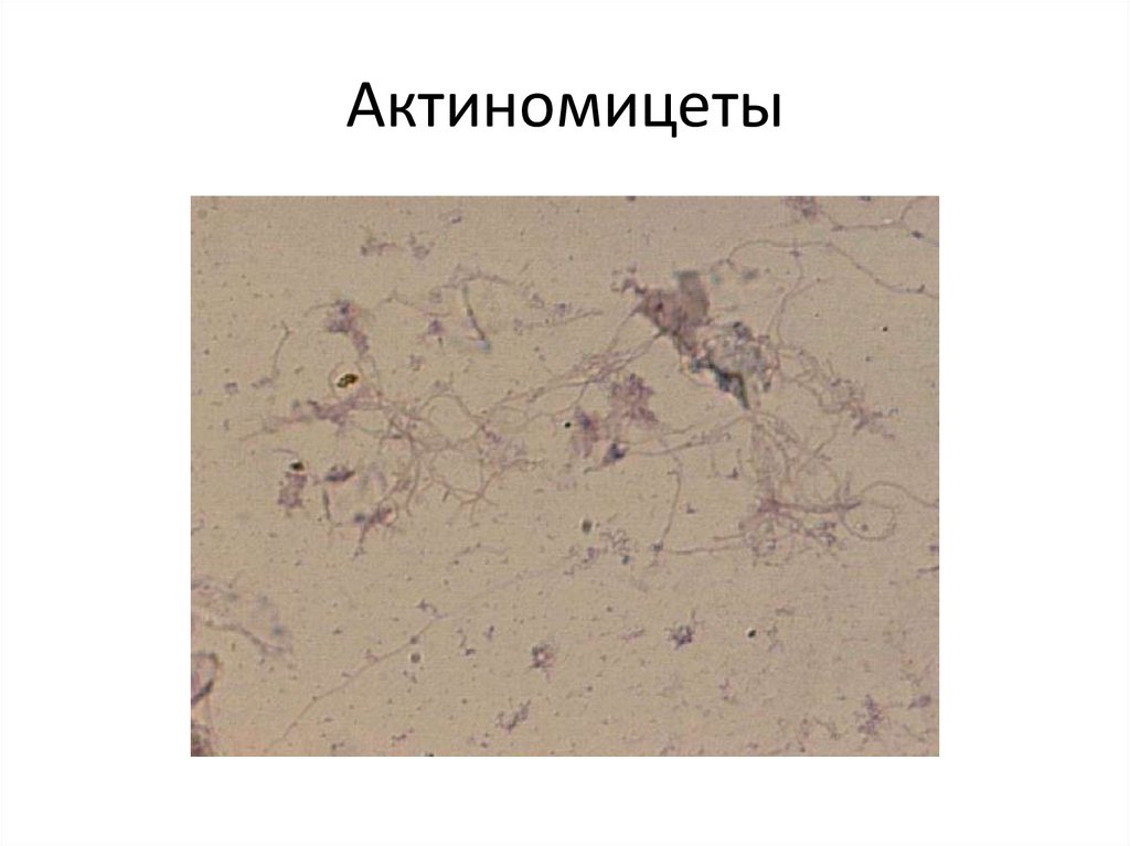 Актиномицеты микробиология презентация