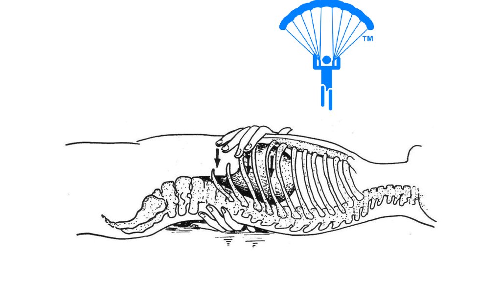 Куполообразная мышца отделяющая грудную полость от брюшной. Сухожильный центр диафрагмы. Грудобрюшная полость гусей и уток в реальности. Диафрагма у собаки расположение. Наличие диафрагмы у млекопитающих