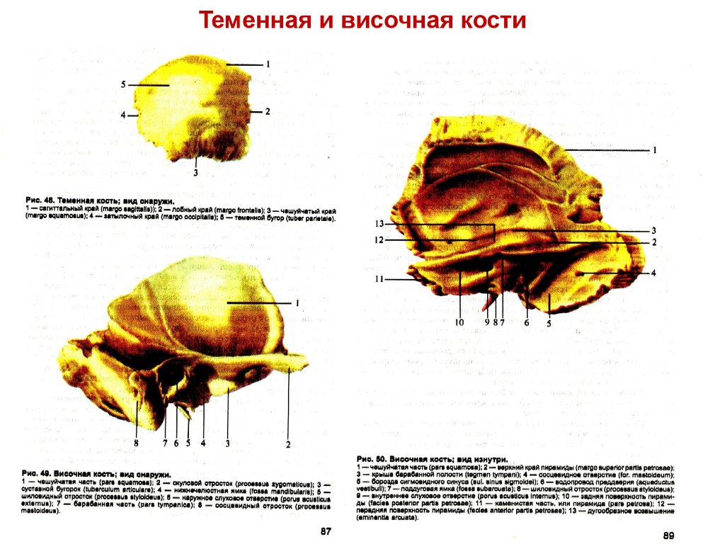 Теменная кость какой тип. Височная и теменная кость. Височная кость и теменная Тип соединения. Соединение теменной и височной костей. Височная кость соединяется с теменной.