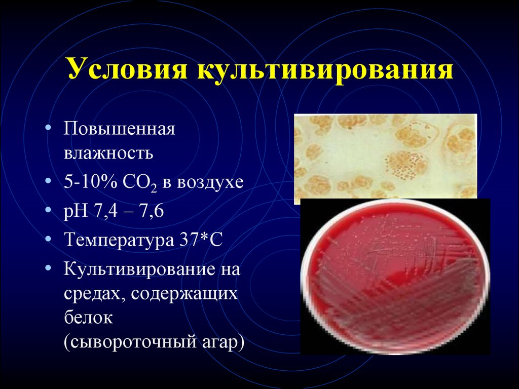 Мазок на менингококковую инфекцию. Менингококковая инфекция культивирование. Среда культивирования менингококковой инфекции. Культивирование в атмосфере 5% со2\.