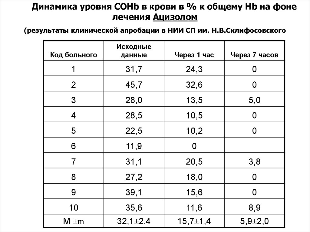 Уровни динамиков