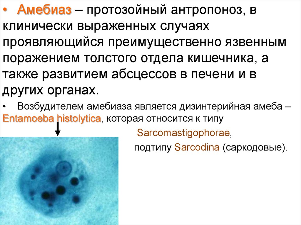 Клиническая картина в острый период амебиаза