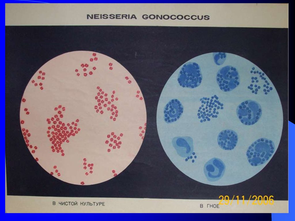 Менингококки микробиология. Neisseria gonorrhoeae чистая культура. Чистая культура гонококка. Возбудитель ВБИ стафилококк.