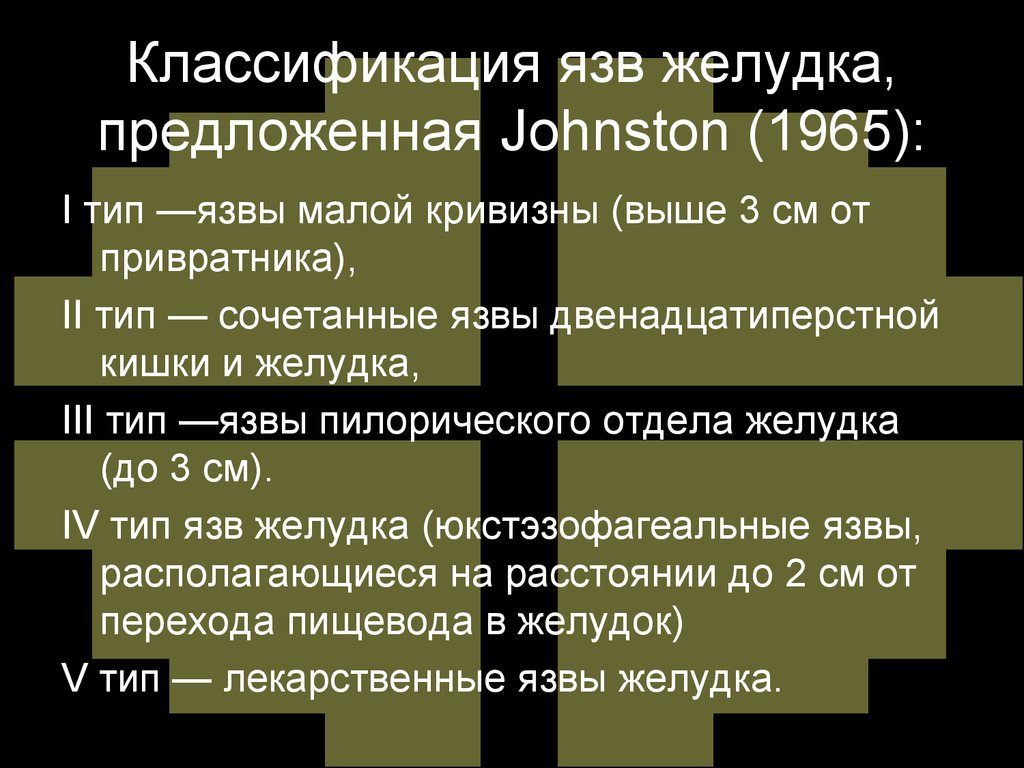 Тип джонсона. Классификация желудочных язв. Язва желудка классификация. Классификация Джонсона язвенной болезни. Классификация Джонсона типы желудочных язв.