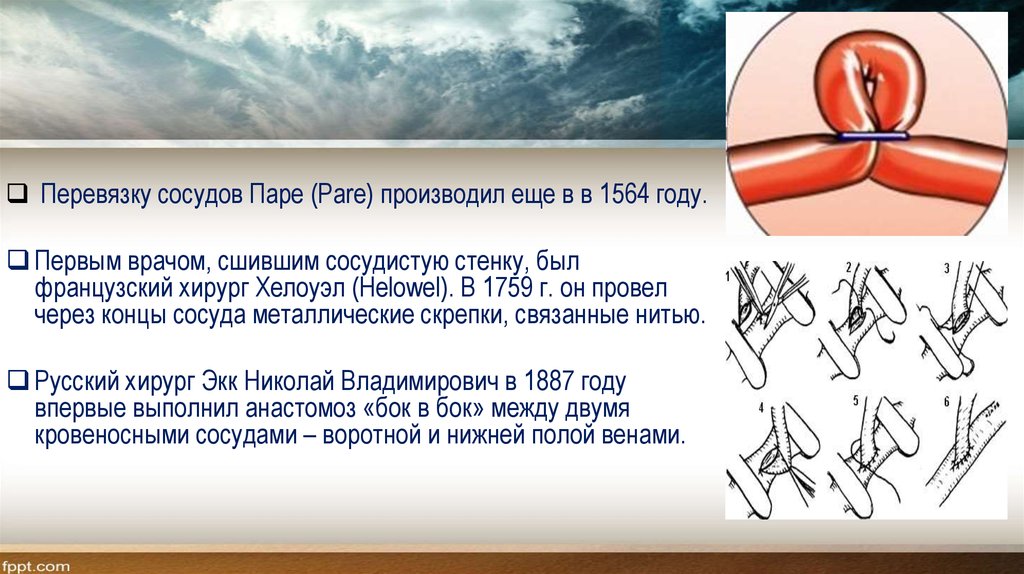 Лоскуты на микрососудистом анастомозе применяемые в челюстно лицевой хирургии презентация