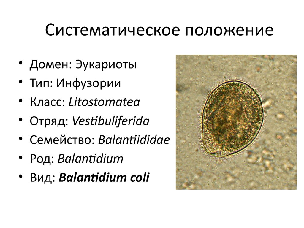 Положение на латыни. Balantidium coli систематика. Balantidium coli классификация. Инфузория балантидий систематика. Балантидий кишечный систематика.