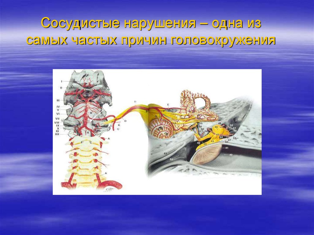 Нарушение равновесия. Вертебро базилярная долихоэктазия. Базилярная Аура. Базилярная мигрень.