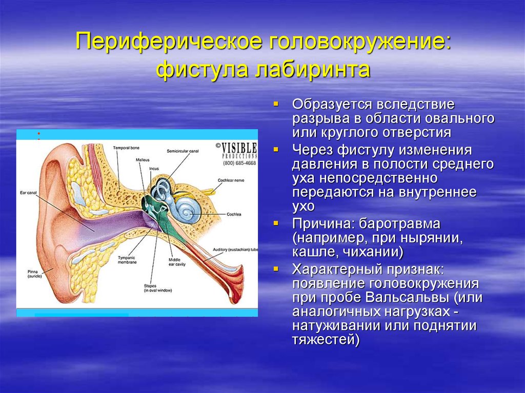 Болезнь внутреннего уха. Среднее ухо головокружение. Заболевание среднего уха головокружение. Внутреннее ухо головокружение. Заболевания внутреннего уха.