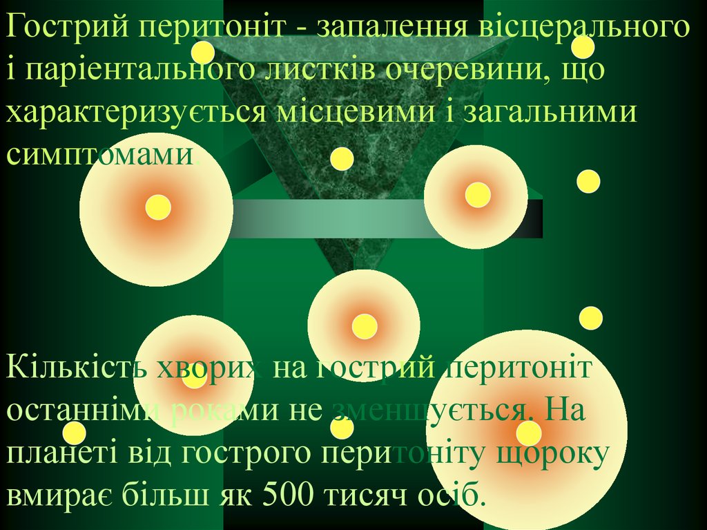 Гострий перитоніт - презентация онлайн