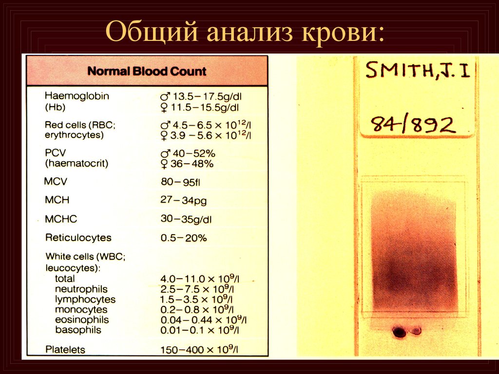 Общий анализ крови взрослого мужчины