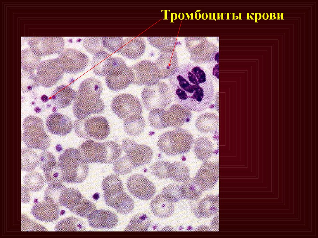 Фото тромбоцитов под микроскопом