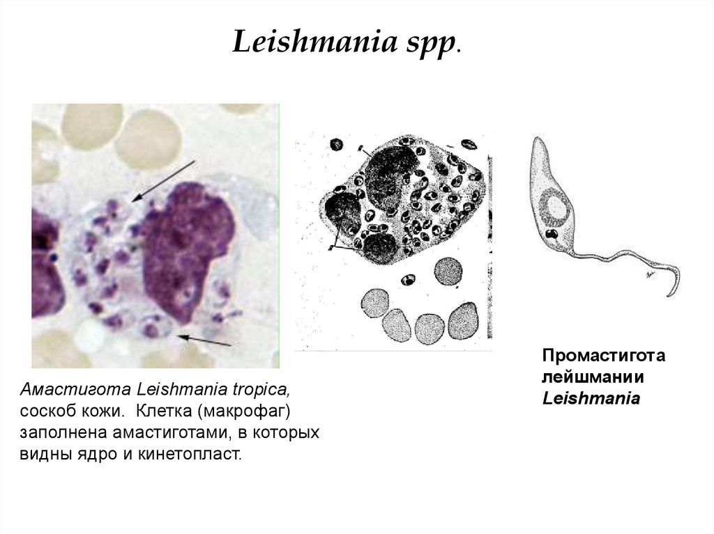 Лейшмании. Амастигота и промастигота лейшмания. Лейшмания амастигота строение. Лейшмания в тканях амастигота.