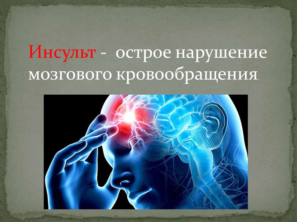 Острый инсульт. Приступ ОНМК. Мозговой удар острое нарушение мозгового кровообращения.