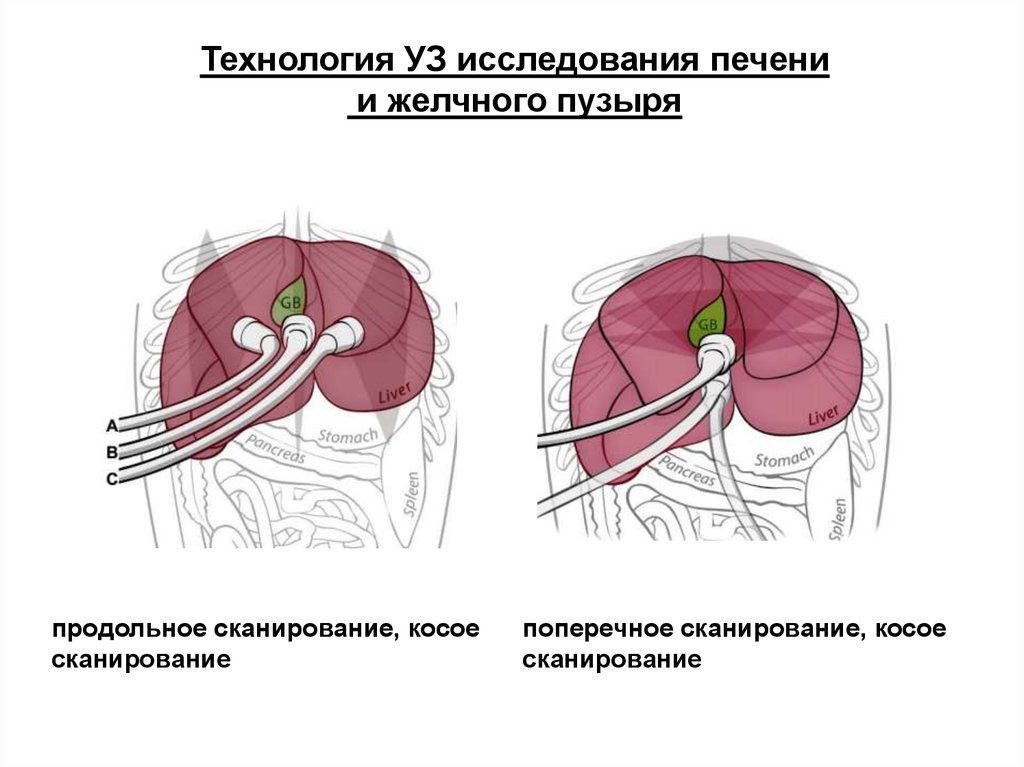 Исследование печени. Инструментальные методы исследования печени и желчного пузыря. Продольное сканирование печени. Продольное и поперечное сканирование печени.