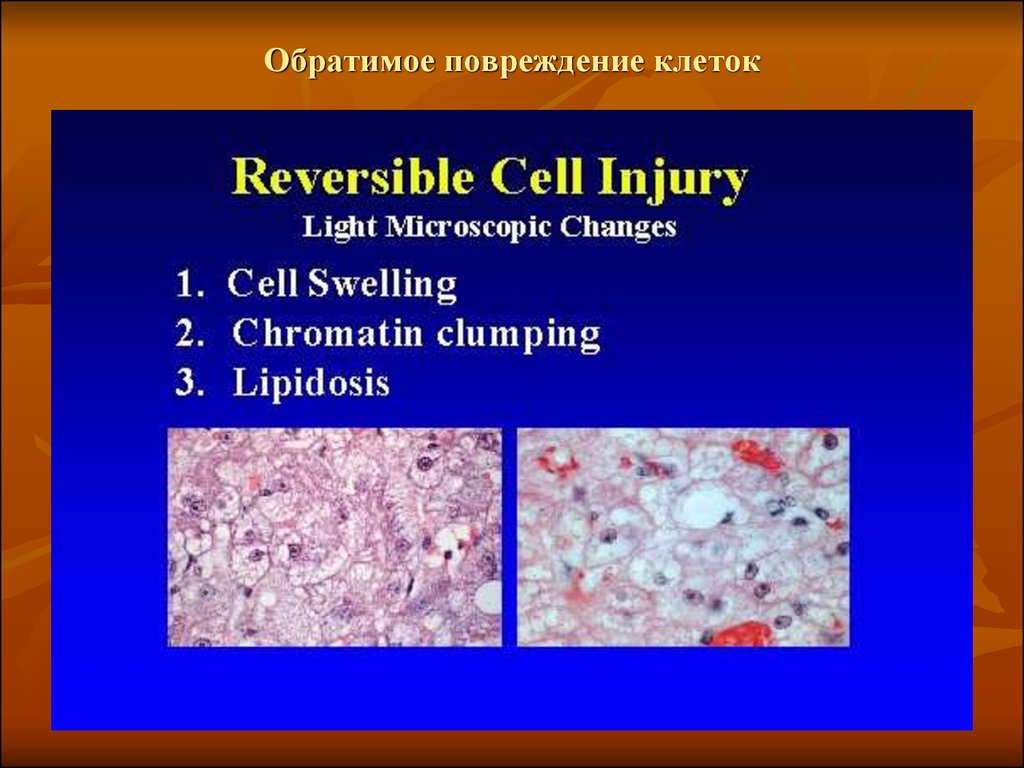 Обратимое повреждение клеток. Паренхиматозная дистрофия внутриклеточные накопления.. Обратимые клеточные повреждения.