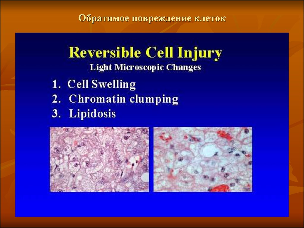 Клетки связаны. Обратимые повреждения клеток. Обратимые и необратимые повреждения клетки. Внутриклеточные дистрофии. Обратимые повреждения клеток и тканей (дистрофии).