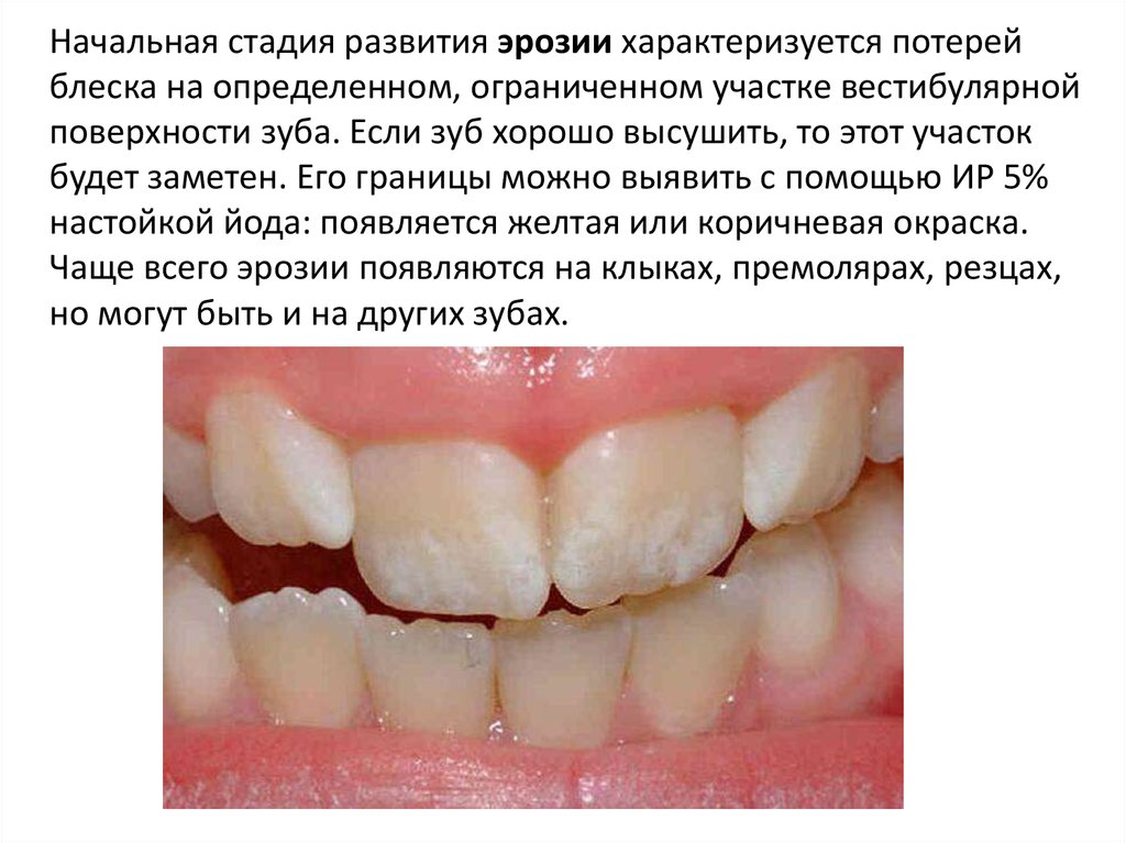 Зубы премоляры фото