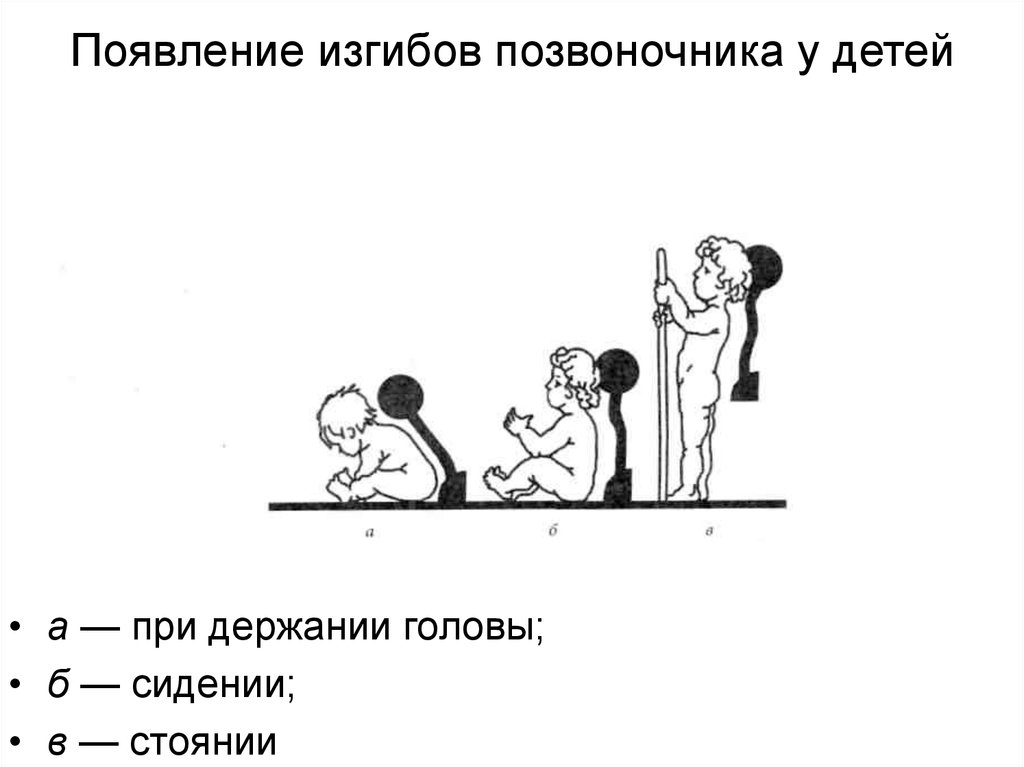 Развитие изгибов позвоночника. Появление изгибов позвоночника. Формирование физиологических изгибов позвоночника у детей. Появление изгибов позвоночника у детей. Формирование изгибов позвоночника у ребенка сроки.