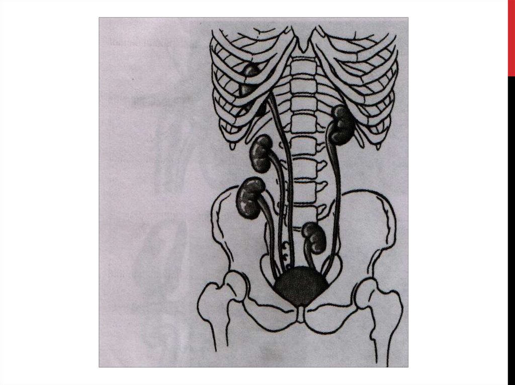 Нефроптоз дистопия. Скелетотопия мочеточника. Скелетотопия почек анатомия.